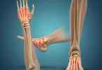 Is Surgery the best option for wrist and ankle Injuries
