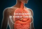 Heartburn