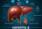 Hepatitis B