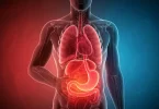 Home Remedies for Acidity and Heartburn in Hindi