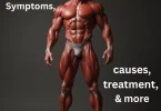 Muscle dysmorphia