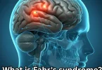 What is Fahr's syndrome?