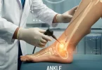 ankle arthroscopy
