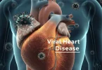 viral Heart disease