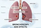 Bronchoscopy side effects