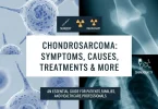 Chondrosarcoma