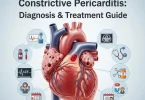 Constrictive pericarditis