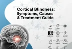 Cortical blindness