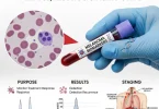 Melanoma blood test