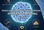 Nodular Lymphocyte-predominant Hodgkins Lymphoma