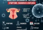 Ovary