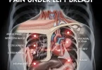 Pain Under Left Breast