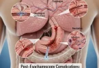 Post-Esophagoscopy
