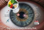 Reduce Geographic Atrophy Risk with Macular Degeneration