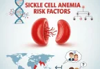 Sickle Cell Anemia Risk Factors