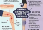 Superficial thrombophlebitis vs deep vein thrombosis