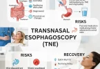 Transnasal esophagoscopy
