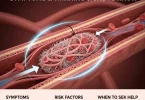 blood clot