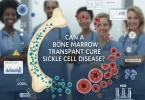 bone marrow transplant