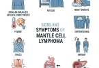 mantle cell lymphoma