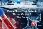 throat cancer