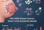 HR+ or HER2– breast cancer