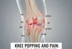 Knee Popping and Pain