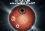 intraretinal microvascular abnormalities