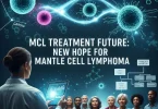 mantle cell lymphoma