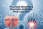 psoriasis severity and psoriatic arthritis