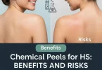 Chemical peel for hidradenitis suppurativa