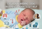 Croup and newborns