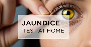 Jaundice Test at Home