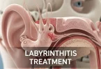 Labyrinthitis Treatment