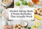 alcohol allergy rash treatment home remedy