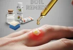 boil remedy