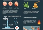 burns with effective home remedies