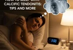calcific tendonitis