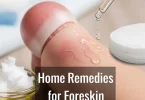 cracked foreskin