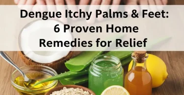 dengue itchy palms and feet home remedies