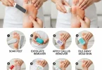 Extreme Foot Callus Removal at Home