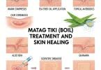 matag tiki treatment