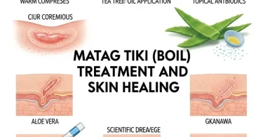 matag tiki treatment