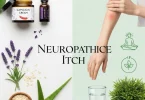 home remedies for neuropathic itch