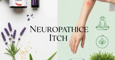 home remedies for neuropathic itch