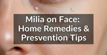 milia on face