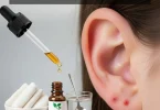 pimple in ear home remedies