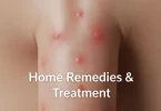 red spots under foreskin not itchy home remedies