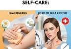 Sebaceous Cyst Self Care