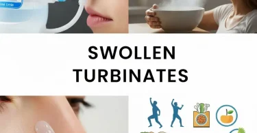 swollen turbinates home remedies